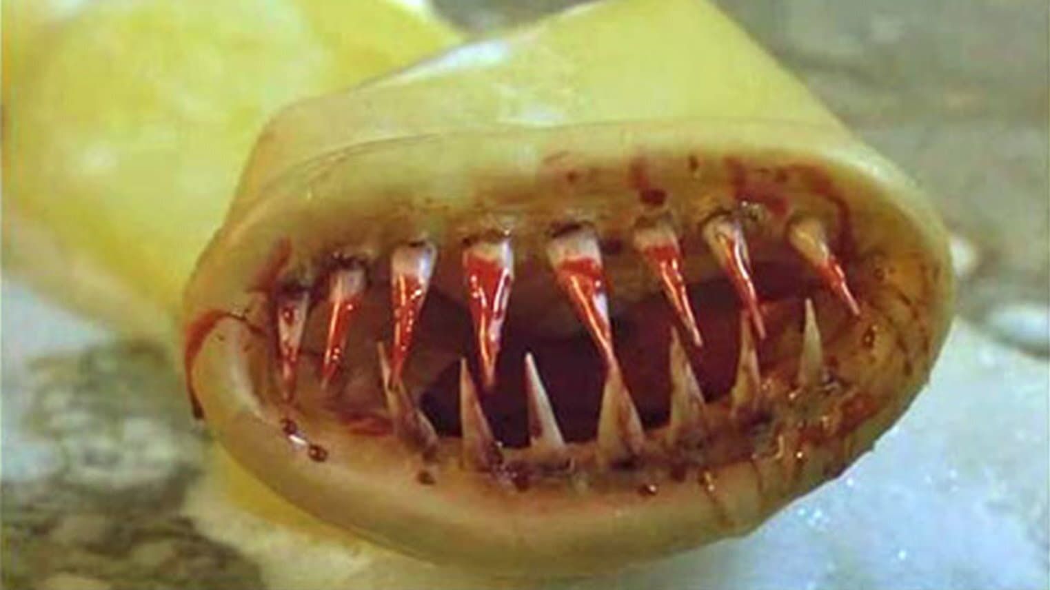 Killer Condom